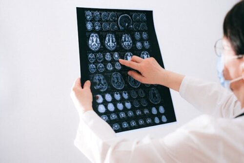 medical professional looking at brain scans